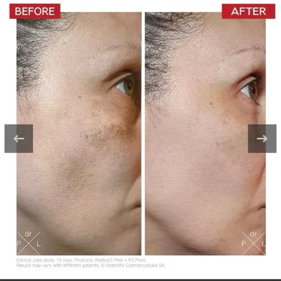 RADICAL3 REBOOT PRO PEEL 50ml
NEW IN BOX / SEALED (RV$99) - Picture 3 of 3